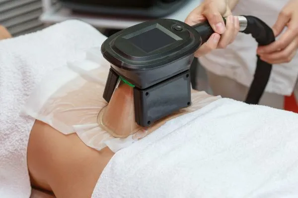 Image of person having fat freezing treatment to help weight gain Corby