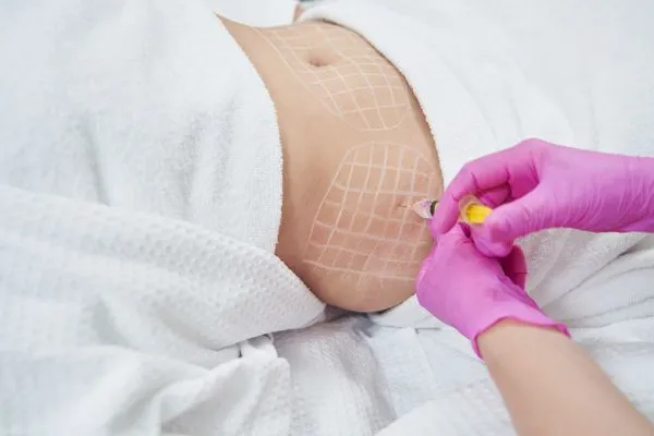 image of fat dissolving injections on love handles to help combat weight gain Corby