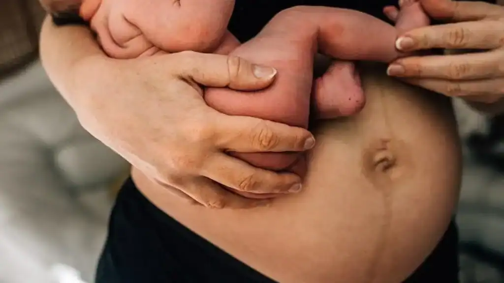 Why Is My Stomach Still Big After Pregnancy Corby?